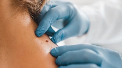 CourseImage_DermatologicalConcepts_1920x1080